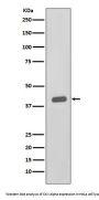 Anti-CKII alpha CSNK2A1 Rabbit Monoclonal Antibody