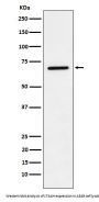 Anti-LTA4H Rabbit Monoclonal Antibody