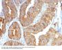 Anti-VEGI (Vascular Endothelial Growth Inhibitor) TNFSF15 Monoclonal Antibody
