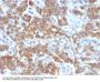 Anti-VEGI (Vascular Endothelial Growth Inhibitor) TNFSF15 Monoclonal Antibody