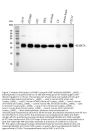 Anti-RAB7 RAB7A Rabbit Monoclonal Antibody