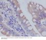 Anti-RAB7 RAB7A Rabbit Monoclonal Antibody