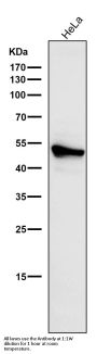 Anti-Cytokeratin 7 KRT7 Rabbit Monoclonal Antibody