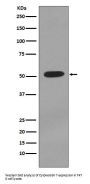Anti-Cytokeratin 7 KRT7 Rabbit Monoclonal Antibody