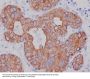 Anti-Cytokeratin 7 KRT7 Rabbit Monoclonal Antibody