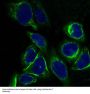 Anti-Cytokeratin 7 KRT7 Rabbit Monoclonal Antibody