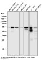 Anti-Cytokeratin 7 KRT7 Rabbit Monoclonal Antibody