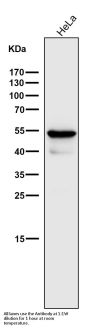 Anti-Cytokeratin 7 KRT7 Rabbit Monoclonal Antibody