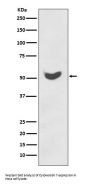 Anti-Cytokeratin 7 KRT7 Rabbit Monoclonal Antibody