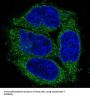 Anti-Cytokeratin 7 KRT7 Rabbit Monoclonal Antibody
