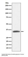 Anti-AMBP Rabbit Monoclonal Antibody