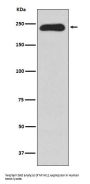 Anti-MYH11 Rabbit Monoclonal Antibody