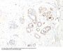 Anti-Smooth Muscle Myosin Heavy Chain (SM-MHC) (Leiomyosarcoma & Myoepithelial Cell Marker) MYH11 Monoclonal Antibody