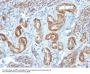 Anti-Smooth Muscle Myosin Heavy Chain (SM-MHC) (Leiomyosarcoma & Myoepithelial Cell Marker) MYH11 Monoclonal Antibody