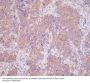 Anti-14-3-3 YWHAB Rabbit Monoclonal Antibody