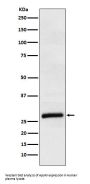 Anti-ApoM Rabbit Monoclonal Antibody