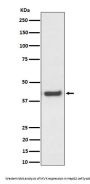 Anti-MVK Rabbit Monoclonal Antibody