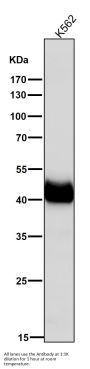 Anti-FABP1/L Fabp Rabbit Monoclonal Antibody