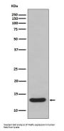 Anti-FABP1/L Fabp Rabbit Monoclonal Antibody