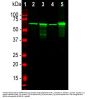 Anti-Neurofilament Light NF-L Antibody