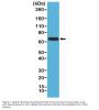 Anti-Neurofilament-L (NF-L) NEFL Rabbit Monoclonal Antibody, Clone#RM280