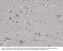 Anti-Neurofilament-L (NF-L) NEFL Rabbit Monoclonal Antibody, Clone#RM280