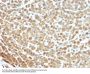 Anti-S100A (Melanoma Marker) S100A1 Monoclonal Antibody