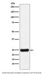 Anti-Cathepsin S CTSS Monoclonal Antibody