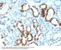 Anti-Milk Fat Globule (Breast Epithelial Marker) Monoclonal Antibody