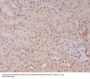Anti-PELP1 Rabbit Monoclonal Antibody