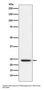 Anti-FNDC5 Rabbit Monoclonal Antibody