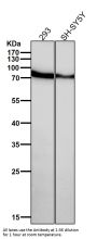 Anti-SMURF 2 Rabbit Monoclonal Antibody