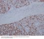 Anti-SATB2 Rabbit Monoclonal Antibody