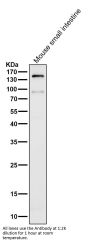Anti-CD13 ANPEP Rabbit Monoclonal Antibody