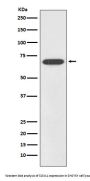 Anti-SOX11 Rabbit Monoclonal Antibody