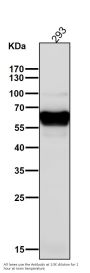 Anti-CaMKII delta CAMK2D Rabbit Monoclonal Antibody
