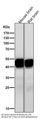 Anti-CaMKII delta CAMK2D Rabbit Monoclonal Antibody