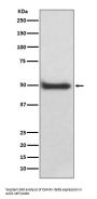 Anti-CaMKII delta CAMK2D Rabbit Monoclonal Antibody