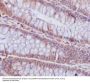 Anti-Caspase-6 CASP6 Rabbit Monoclonal Antibody
