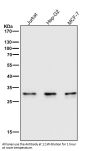 Anti-Caspase-6 CASP6 Rabbit Monoclonal Antibody