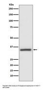 Anti-Caspase-6 CASP6 Rabbit Monoclonal Antibody