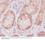 Anti-Caspase-6 CASP6 Rabbit Monoclonal Antibody