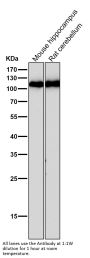 Anti-GluR1 GRIA1 Rabbit Monoclonal Antibody