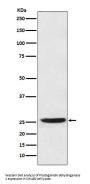 Anti-PGDH Rabbit Monoclonal Antibody