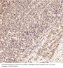 Anti-JNK2 MAPK9 Rabbit Monoclonal Antibody