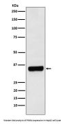 Anti-PRKRA Rabbit Monoclonal Antibody