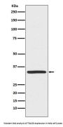 Anti-TRADD Monoclonal Antibody