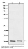 Anti-S100A10 Rabbit Monoclonal Antibody
