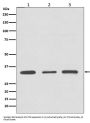 Anti-ATF5 Rabbit Monoclonal Antibody