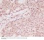 Anti-ATF5 Rabbit Monoclonal Antibody